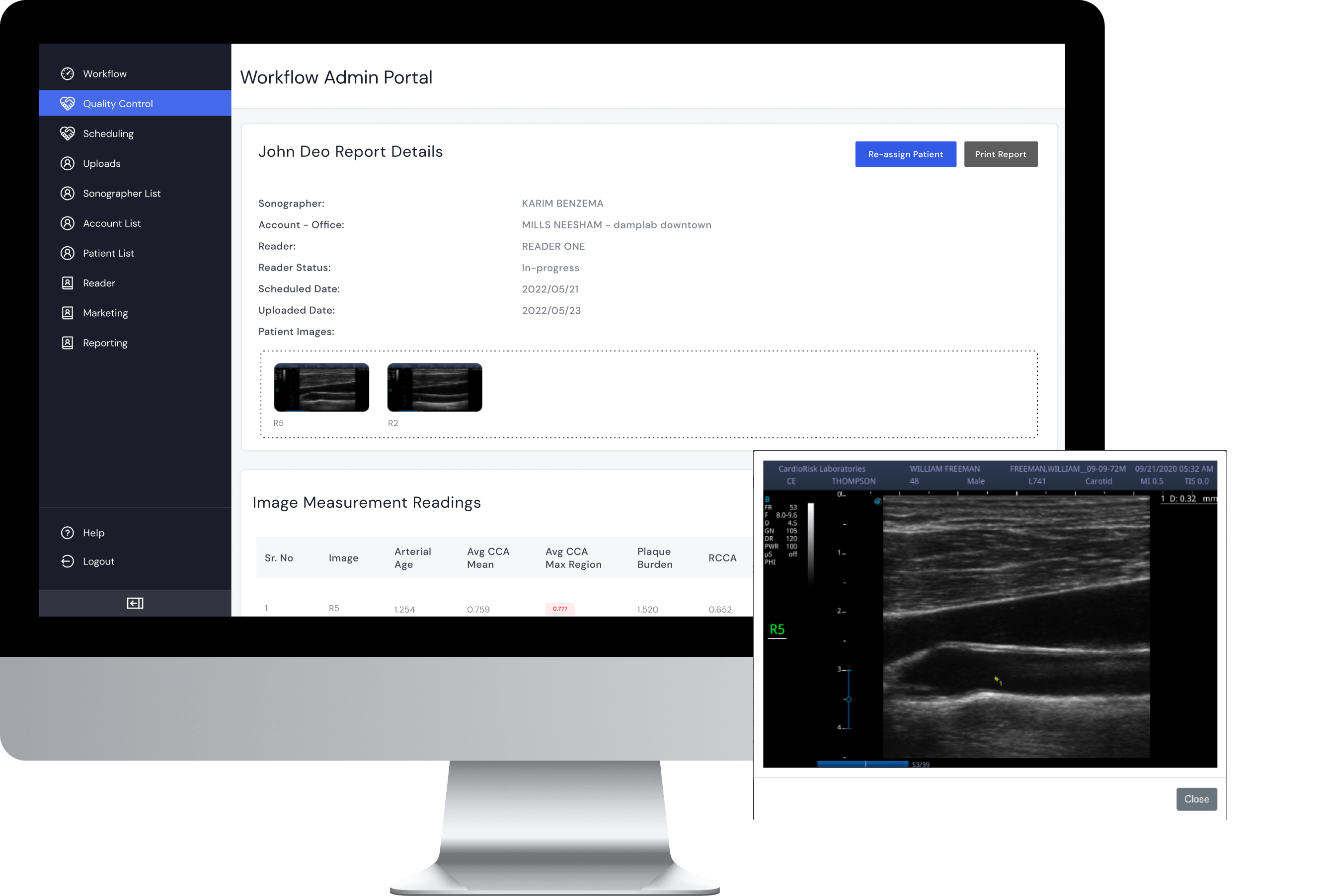web-based annotation tool for ultrasound images